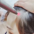 Scalp Treatments for Hair Growth: Regaining Your Confidence