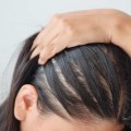 Hairstyles for Thinning Hair: Solutions and Treatments to Prevent Baldness or Hair Loss