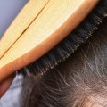 Stress and Hair Loss: Understanding the Connection