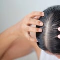 Scalp Massage for Hair Growth: Tips and Techniques to Combat Baldness and Promote Regrowth
