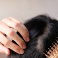 Understanding Iron-Deficiency Anemia and Hair Loss