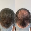 All you need to know about Hair Fibers