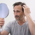 Understanding Alopecia: Causes, Prevention, and Treatment