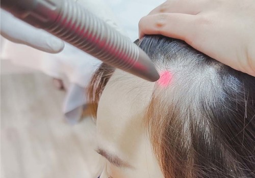 Scalp Treatments for Hair Growth: Regaining Your Confidence