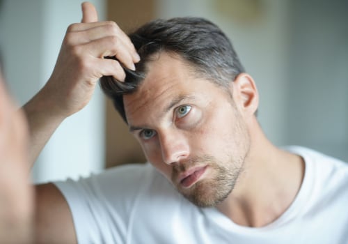 Hormonal Imbalances and Hair Loss: Causes, Treatment, and Prevention