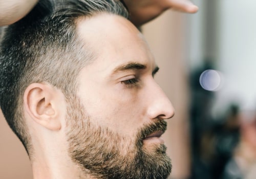 Hair care routine for managing male pattern baldness