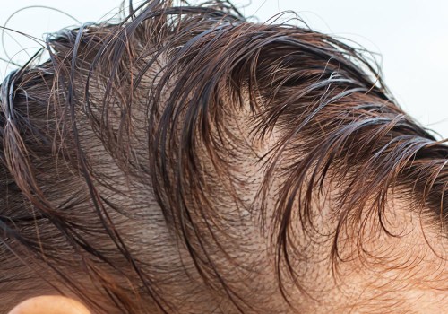 Understanding Vitamin D for Hair Growth