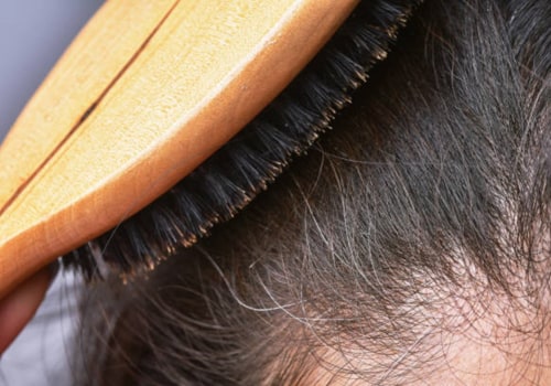 Stress and Hair Loss: Understanding the Connection