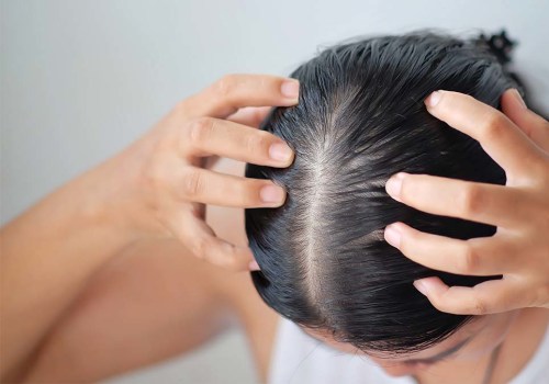 Scalp Massage for Hair Growth: Tips and Techniques to Combat Baldness and Promote Regrowth