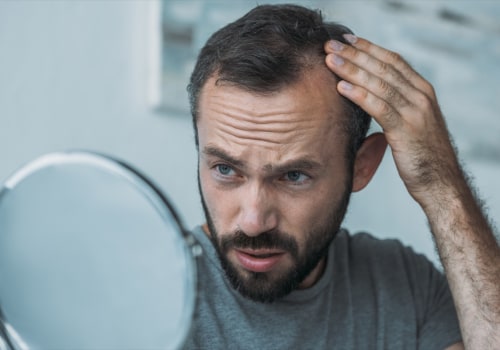 Poor Diet and Hair Loss: What You Need to Know