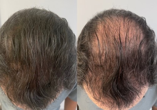 All you need to know about Hair Fibers